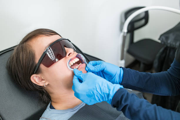 Best Knocked-Out Tooth (Avulsed Tooth) Treatment in Natchitoches, LA